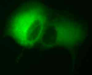 GFP Experiment